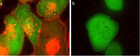 CLL1 Validation
